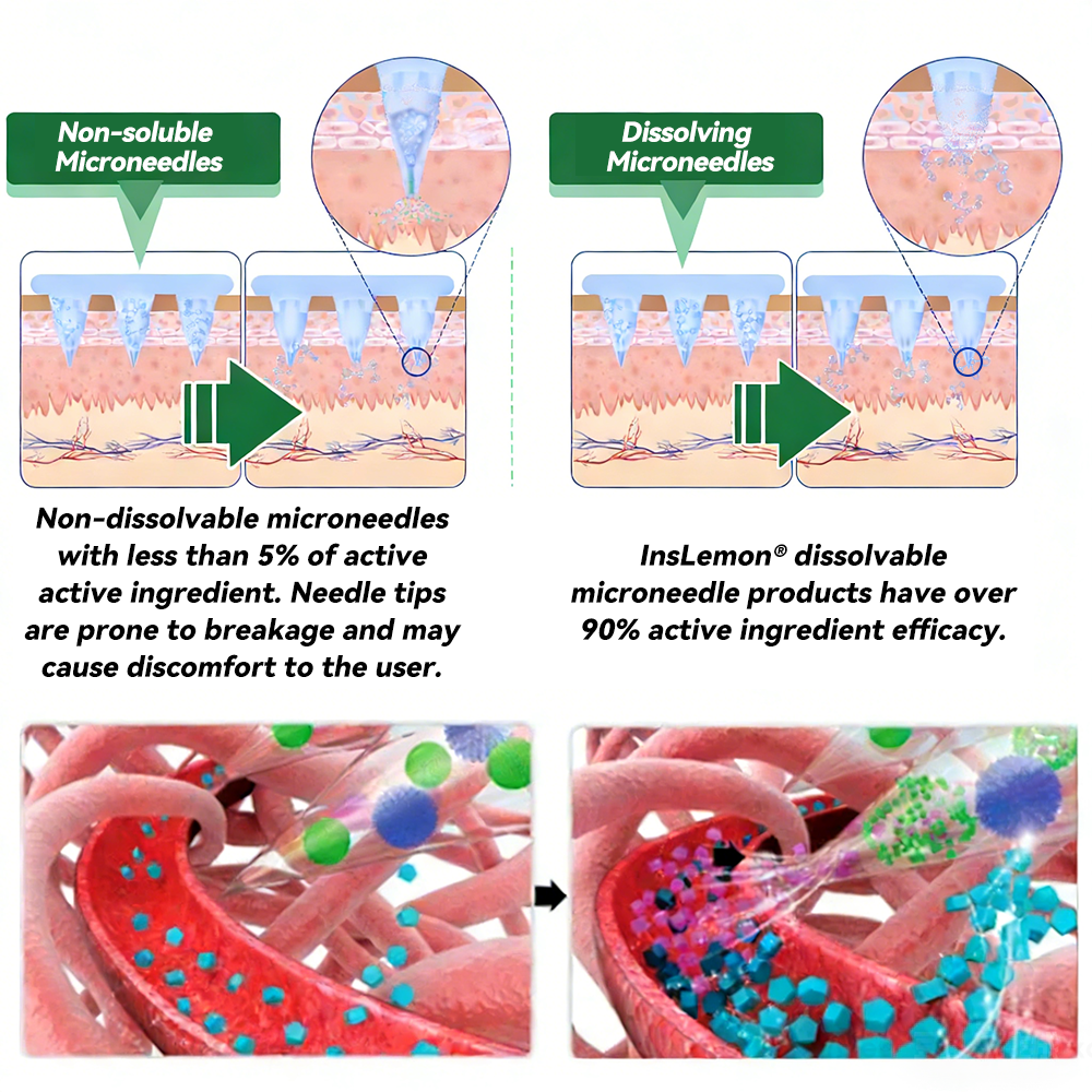 𝐅𝐃𝐀 𝐑𝐞𝐠𝐢𝐬𝐭𝐞𝐫𝐞𝐝 & 𝐆𝐌𝐏 𝐂𝐞𝐫𝐭𝐢𝐟𝐢𝐞𝐝 🎗️|𝐈𝐧𝐬𝐋𝐞𝐦𝐨𝐧® 𝗠𝗼𝗿𝗶𝗻𝗴𝗮 × 𝗕𝗲𝗿𝗯𝗲𝗿𝗶𝗻𝗲 × 𝗔𝗠𝗣𝗞 𝟭𝟬-𝗶𝗻-𝟭 𝗠𝗲𝘁𝗮𝗯𝗼𝗹𝗶𝗰 𝗦𝘂𝗽𝗽𝗼𝗿𝘁 𝗡𝗮𝗻𝗼 𝗠𝗶𝗰𝗿𝗼𝗻𝗲𝗲𝗱𝗹𝗲 𝗣𝗮𝘁𝗰𝗵🇺🇸(𝐉𝐮𝐬𝐭 𝐨𝐧𝐜𝐞 𝐚 𝐝𝐚𝐲, 𝐯𝐢𝐬𝐢𝐛𝐥𝐞 𝐜𝐡𝐚𝐧𝐠𝐞𝐬 𝐢𝐧 𝟕 𝐝𝐚𝐲𝐬） ✅ 𝐅𝐨𝐫 𝐨𝐛𝐞𝐬𝐢𝐭𝐲, 🅛🅞🅞🅢🅔 🅢🅚🅘🅝,𝐝𝐢𝐚𝐛𝐞𝐭𝐞𝐬, 𝐬𝐥𝐞𝐞𝐩 𝐚𝐩𝐧𝐞𝐚, 𝐣𝐨𝐢𝐧𝐭 𝐢𝐬𝐬𝐮𝐞𝐬, 𝐚𝐧𝐝 𝐦𝐨𝐫𝐞
