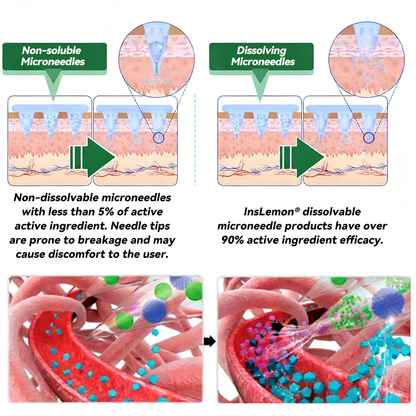 𝐅𝐃𝐀 𝐑𝐞𝐠𝐢𝐬𝐭𝐞𝐫𝐞𝐝 & 𝐆𝐌𝐏 𝐂𝐞𝐫𝐭𝐢𝐟𝐢𝐞𝐝 🎗️|𝐈𝐧𝐬𝐋𝐞𝐦𝐨𝐧® 𝗠𝗼𝗿𝗶𝗻𝗴𝗮 × 𝗕𝗲𝗿𝗯𝗲𝗿𝗶𝗻𝗲 × 𝗔𝗠𝗣𝗞 𝟭𝟬-𝗶𝗻-𝟭 𝗠𝗲𝘁𝗮𝗯𝗼𝗹𝗶𝗰 𝗦𝘂𝗽𝗽𝗼𝗿𝘁 𝗡𝗮𝗻𝗼 𝗠𝗶𝗰𝗿𝗼𝗻𝗲𝗲𝗱𝗹𝗲 𝗣𝗮𝘁𝗰𝗵🇺🇸(𝐉𝐮𝐬𝐭 𝐨𝐧𝐜𝐞 𝐚 𝐝𝐚𝐲, 𝐯𝐢𝐬𝐢𝐛𝐥𝐞 𝐜𝐡𝐚𝐧𝐠𝐞𝐬 𝐢𝐧 𝟕 𝐝𝐚𝐲𝐬） ✅ 𝐅𝐨𝐫 𝐨𝐛𝐞𝐬𝐢𝐭𝐲, 🅛🅞🅞🅢🅔 🅢🅚🅘🅝,𝐝𝐢𝐚𝐛𝐞𝐭𝐞𝐬, 𝐬𝐥𝐞𝐞𝐩 𝐚𝐩𝐧𝐞𝐚, 𝐣𝐨𝐢𝐧𝐭 𝐢𝐬𝐬𝐮𝐞𝐬, 𝐚𝐧𝐝 𝐦𝐨𝐫𝐞
